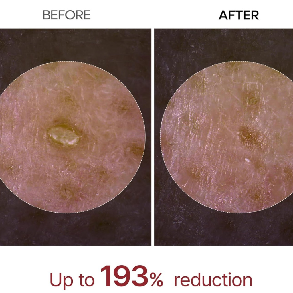 Dr. Melaxin Peel Shot Glow : Black Rice Peeling Ampoule