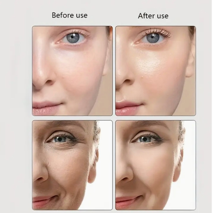 6-in-1 Age R booster pro Professional micro-current Face Massager